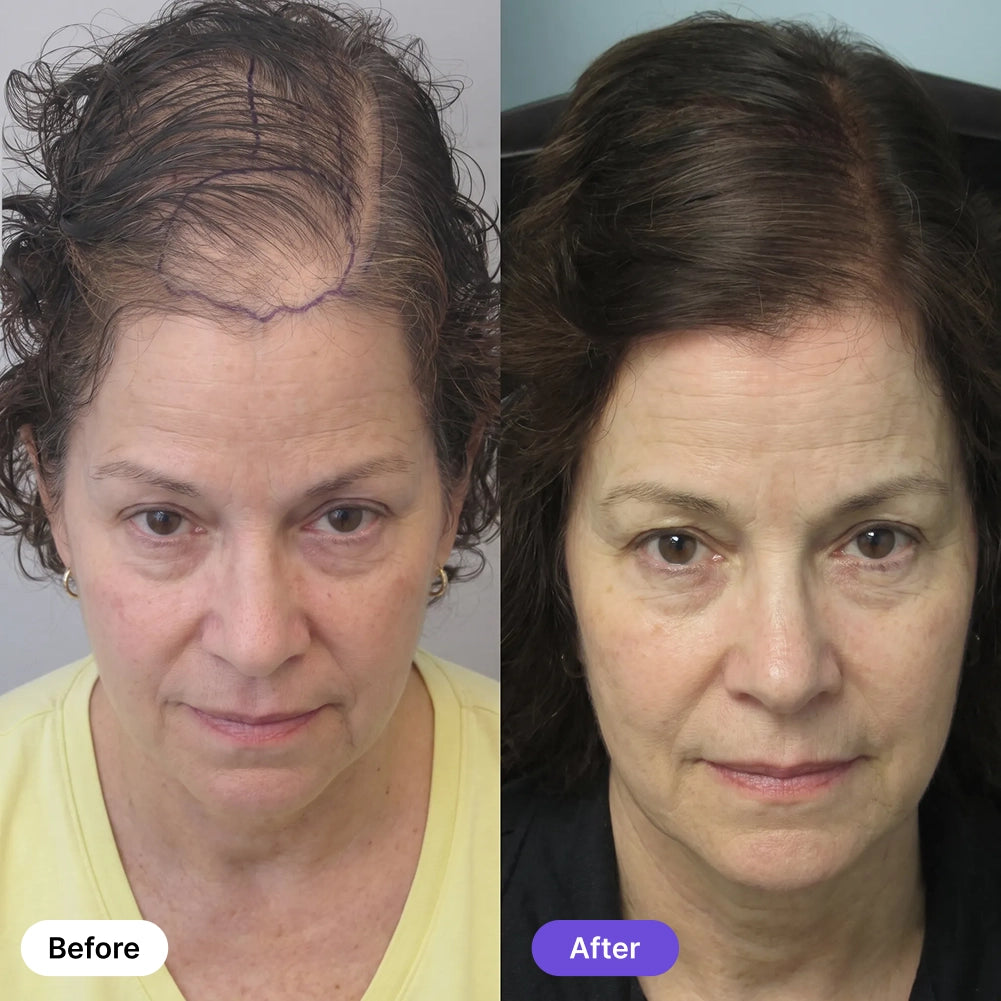 Hair Peptide Regrowth System